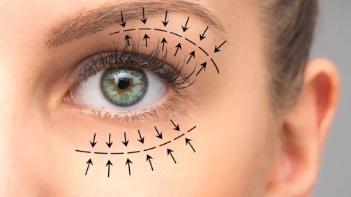 جراحات تجميل الجفون الوظيفية والتجميلية