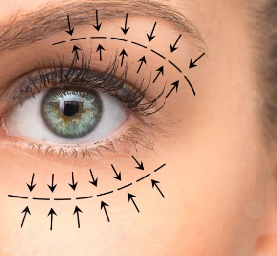 جراحات تجميل الجفون الوظيفية والتجميلية