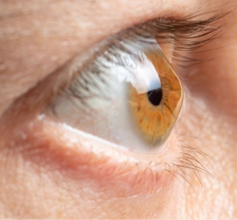 keratoconus-research
